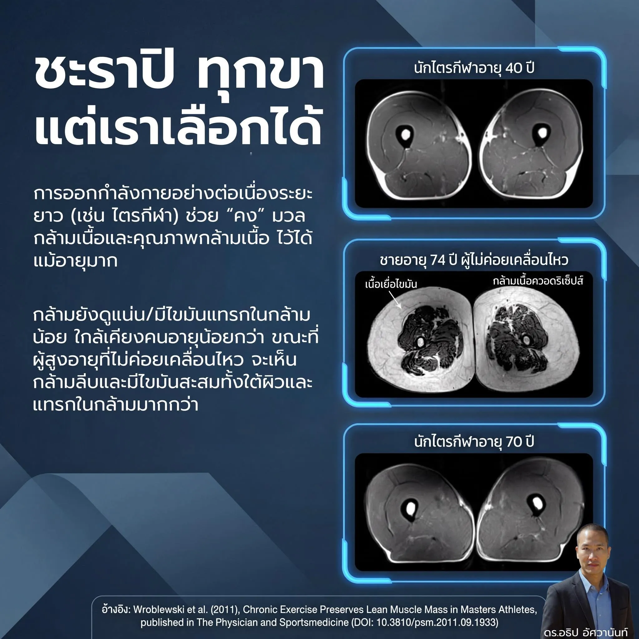 ชะราปิ ทุกขา แต่เราเลือกได้